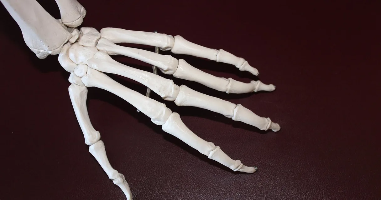 Modelo anatômico de mão esquelética sobre superfície escura, ilustrando a articulação que estala