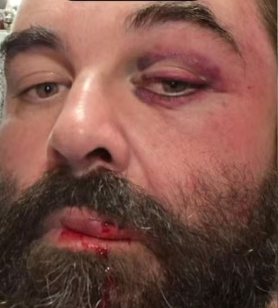 Homem é agredido após reclamar de som alto em igreja de SC Homem é agredido após reclamar de som alto em igreja de SC